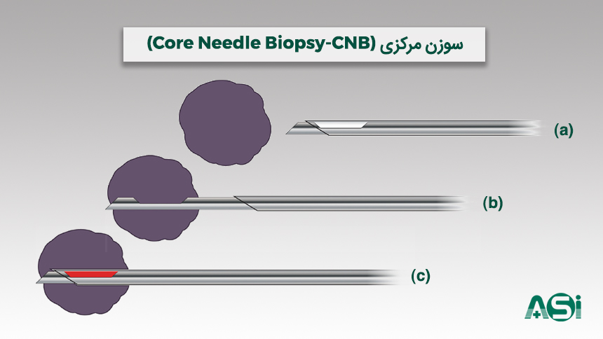 سوزن نمونه برداری