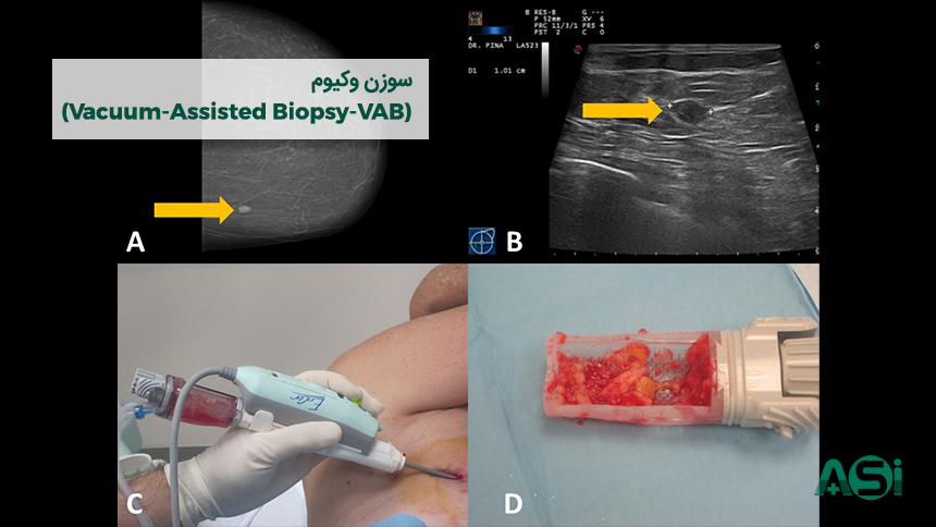 سوزن نمونه برداری