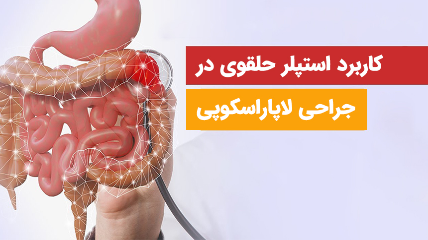 استپلر حلقوی