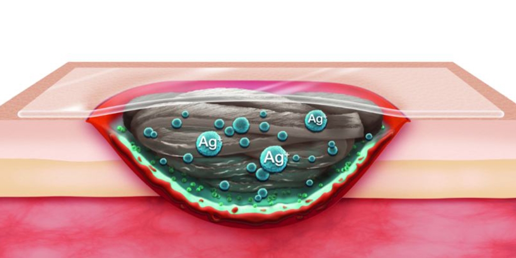 Suprasorb P (سوپرازورب پلی یورتان)