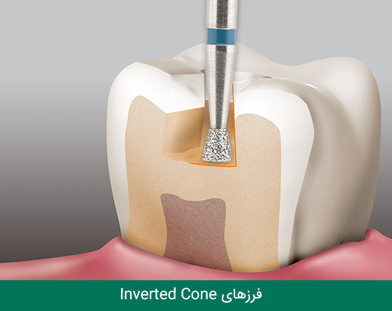 فرز دندانپزشکی مایزینگر