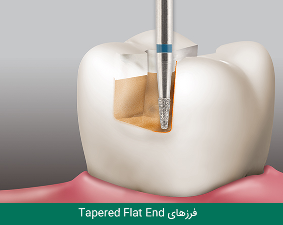 فرز دندانپزشکی مایزینگر