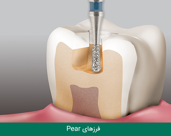 فرز دندانپزشکی مایزینگر