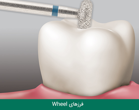 فرز دندانپزشکی مایزینگر