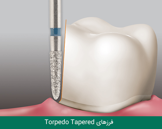 فرز دندانپزشکی مایزینگر