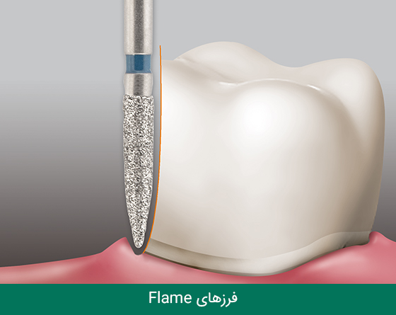 فرز دندانپزشکی مایزینگر