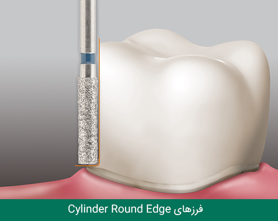 فرز دندانپزشکی مایزینگر