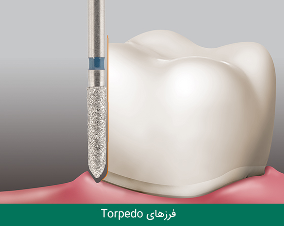 فرز دندانپزشکی مایزینگر