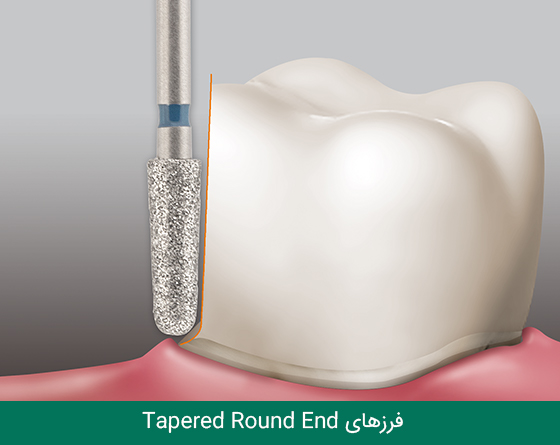 فرز دندانپزشکی مایزینگر