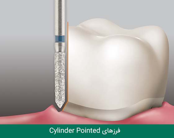 فرز دندانپزشکی مایزینگر
