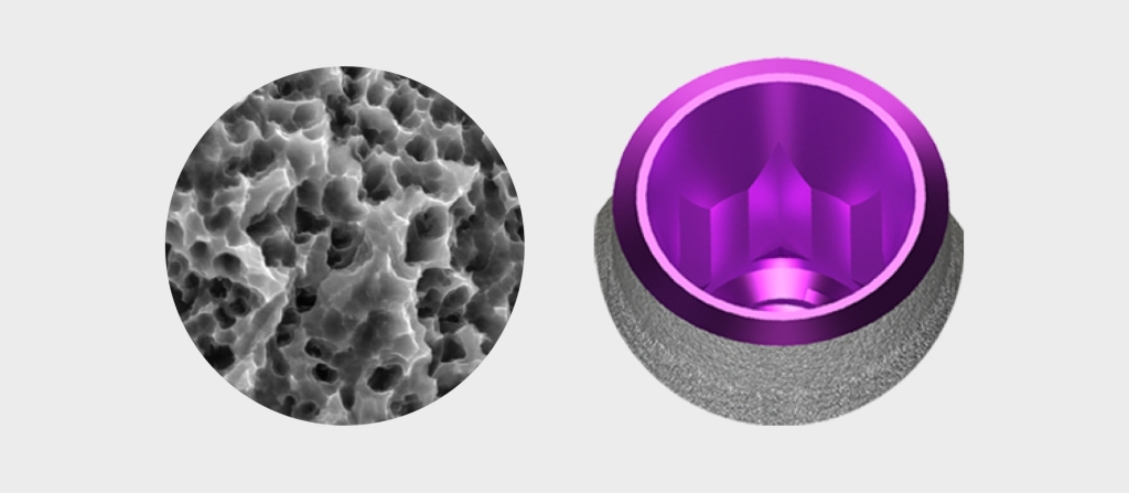 fix-implant-4 ایمپلنت فیکس بایوتری